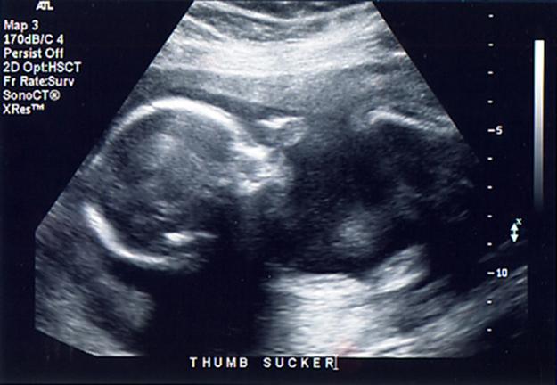 17.7 Ultrasound | Texas Gateway